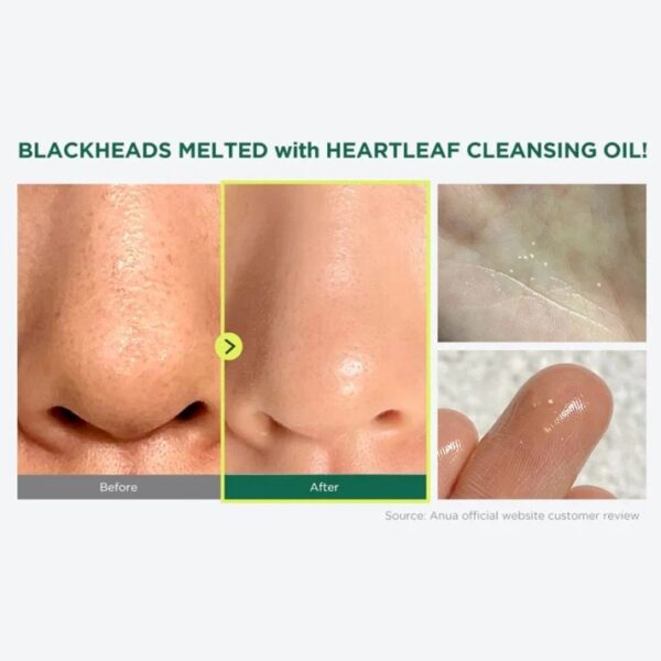 ANUA Heartleaf Pore Control Cleansing Oil Mini 20ml - Image 3